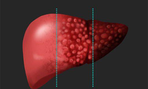 ת��ø���Ǹ����� ת��ø�ߵ�Σ��